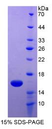 SDS-PAGE (CEACAM6-8197H).jpg